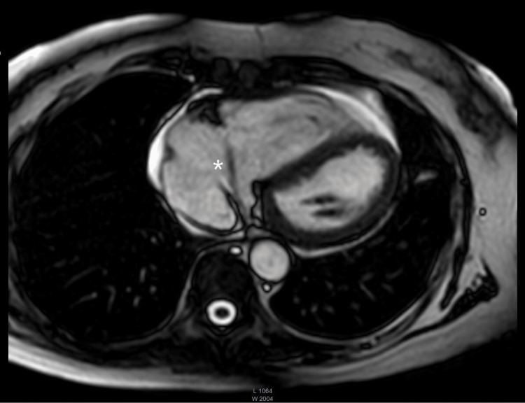 Figure 9