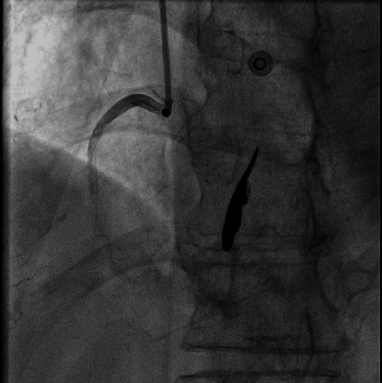 Figure 11