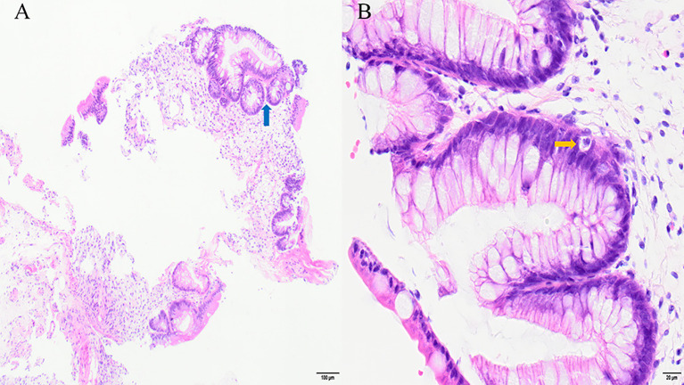 Figure 2