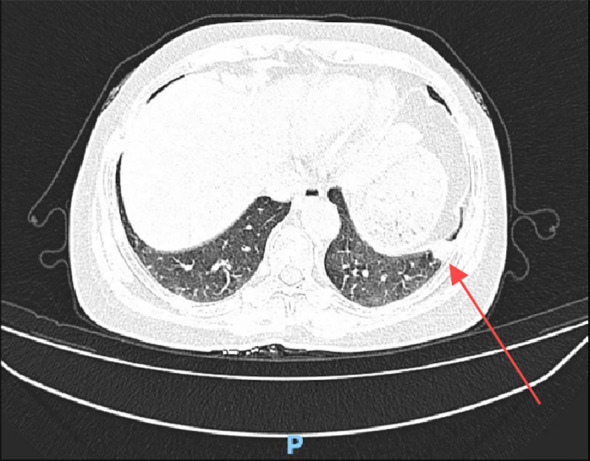 Figure 1