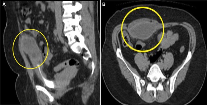 FIGURE 1