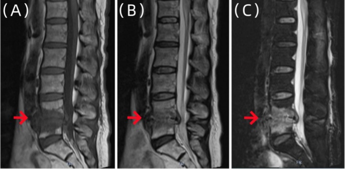 FIGURE 2