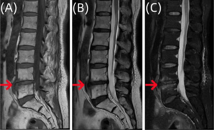 FIGURE 1