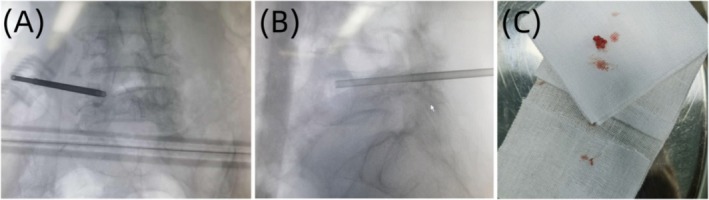 FIGURE 4