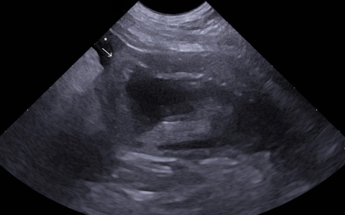 FIG 1