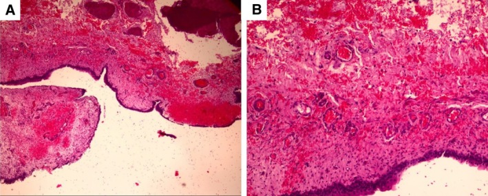 FIG 4
