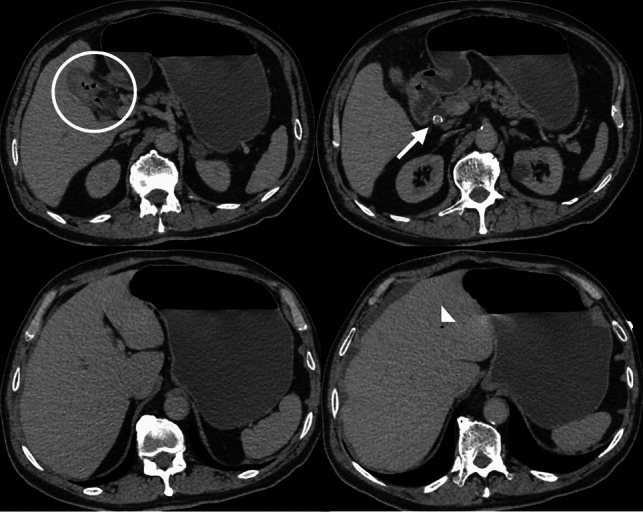 Figure 11