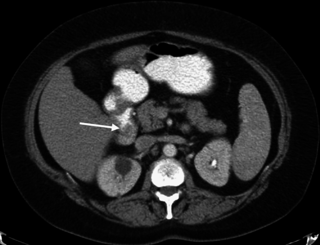 Figure 14