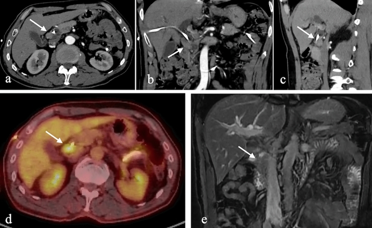 Figure 17