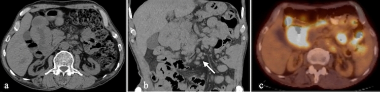 Figure 19