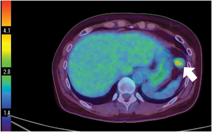 Fig. 2