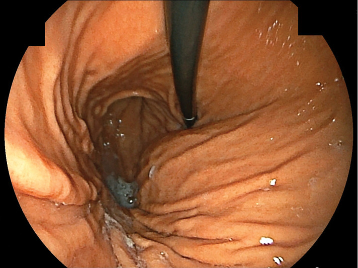 Fig. 3