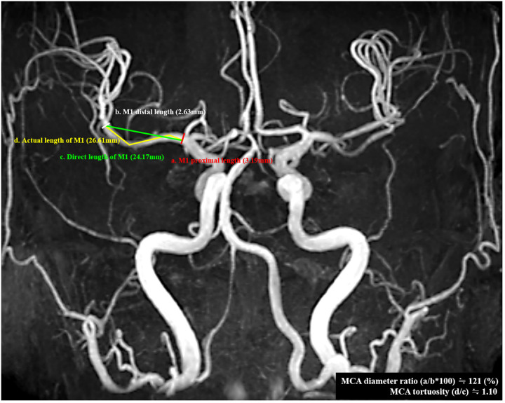 Fig 1