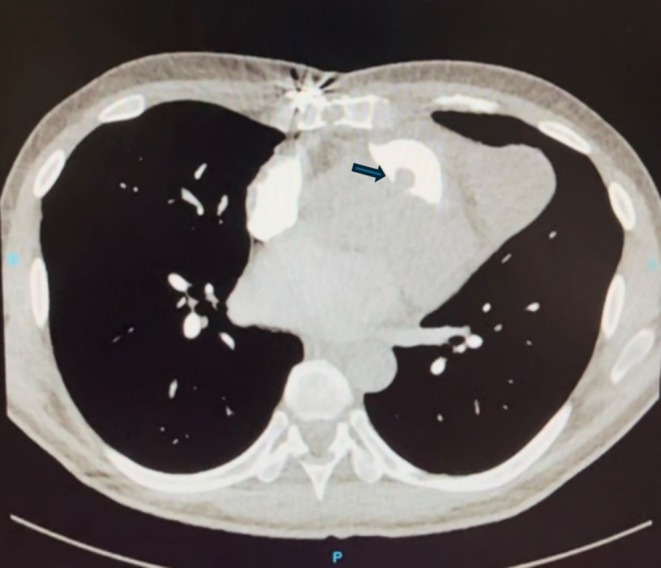 FIGURE 3