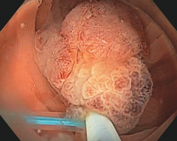 Fig. 4