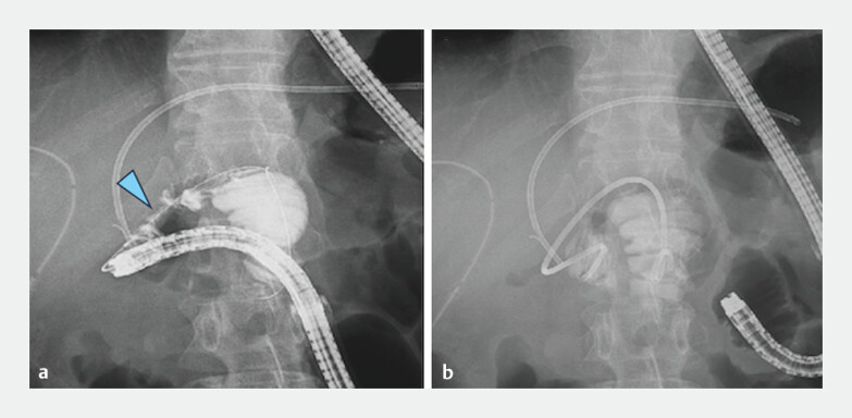 Fig. 5