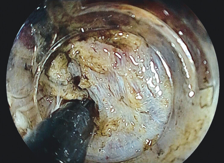 Fig. 4