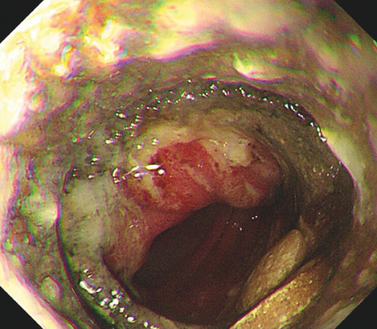Fig. 2