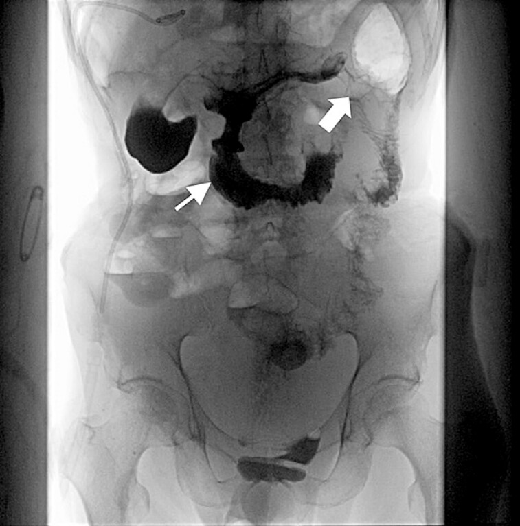 Fig. 4