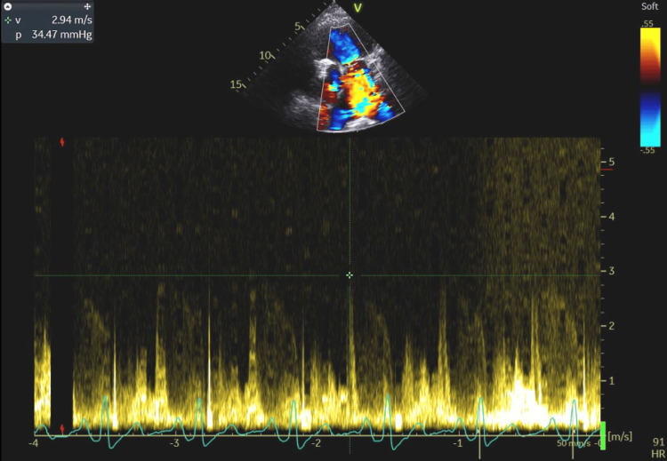 Figure 9
