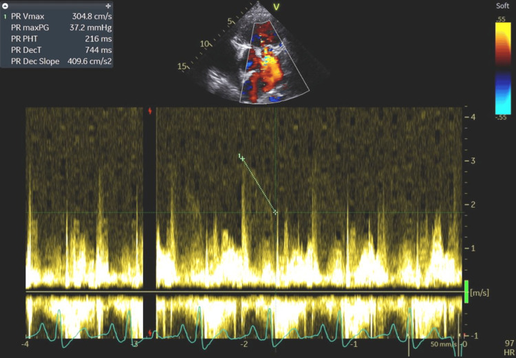 Figure 10
