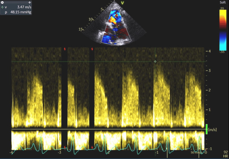 Figure 11