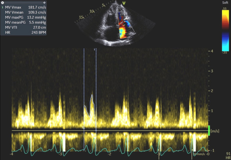 Figure 12