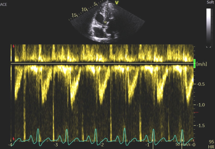 Figure 13
