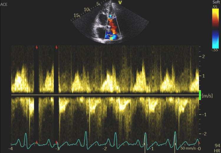 Figure 14