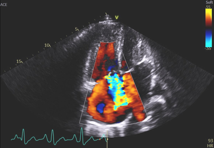 Figure 15