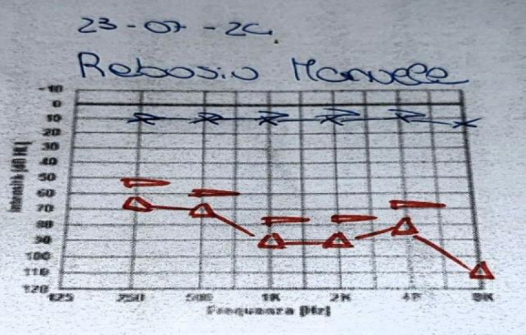 Fig 4
