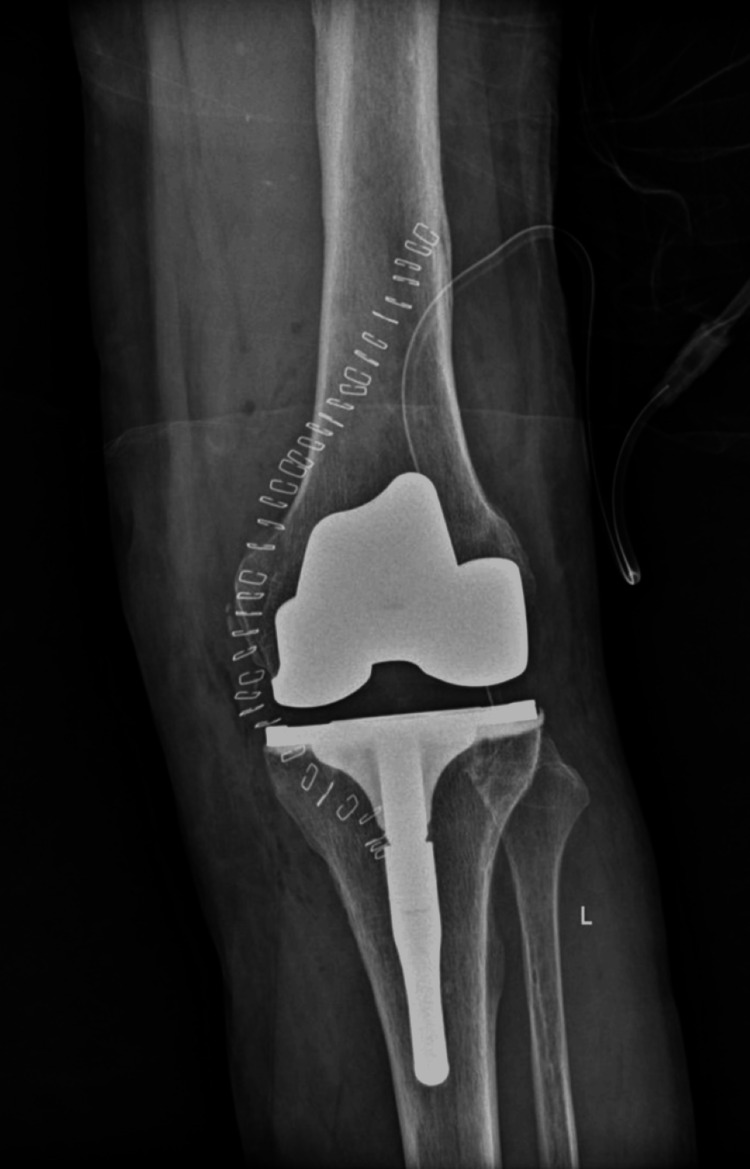 Figure 10