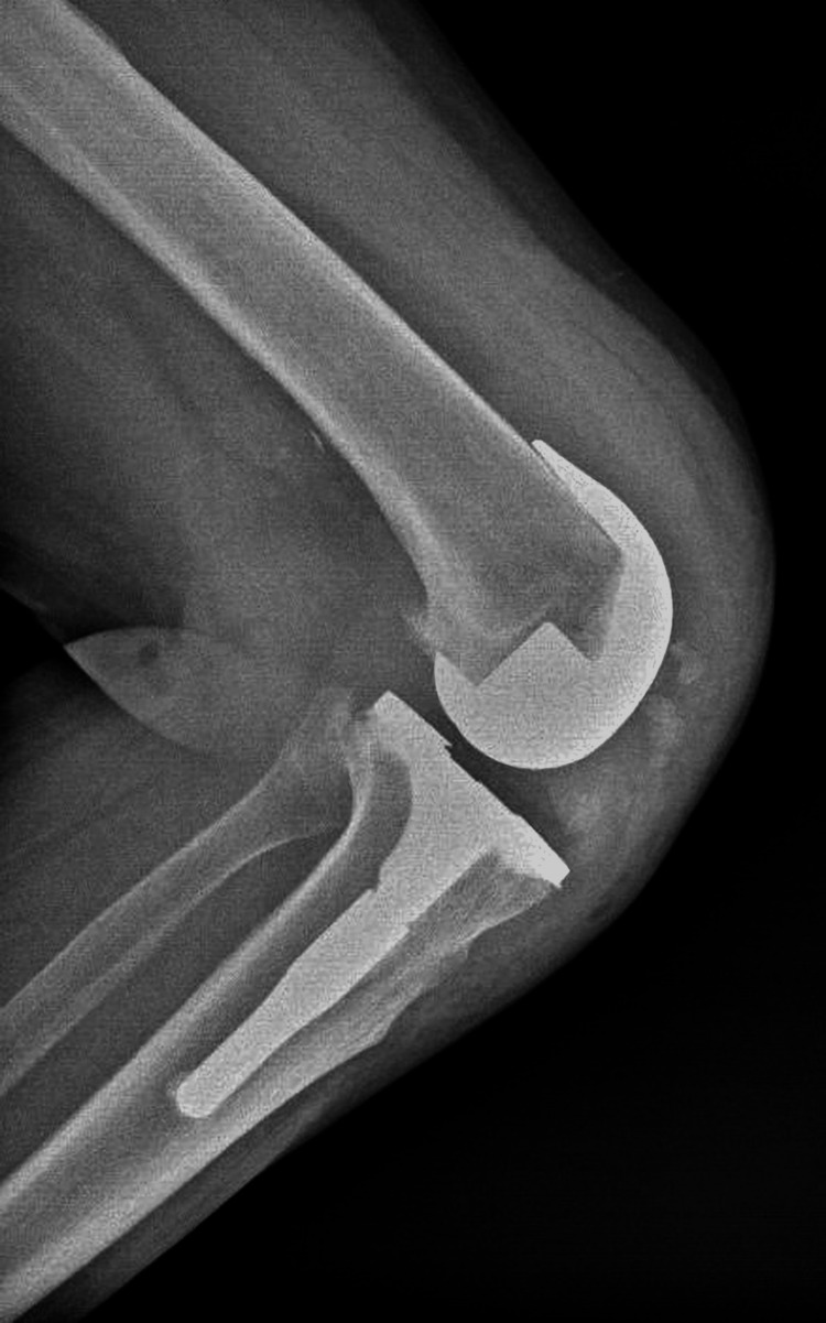 Figure 13