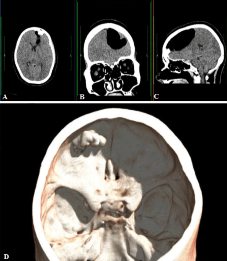 Figure 2