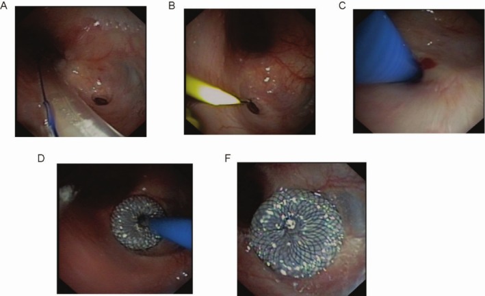 FIGURE 1
