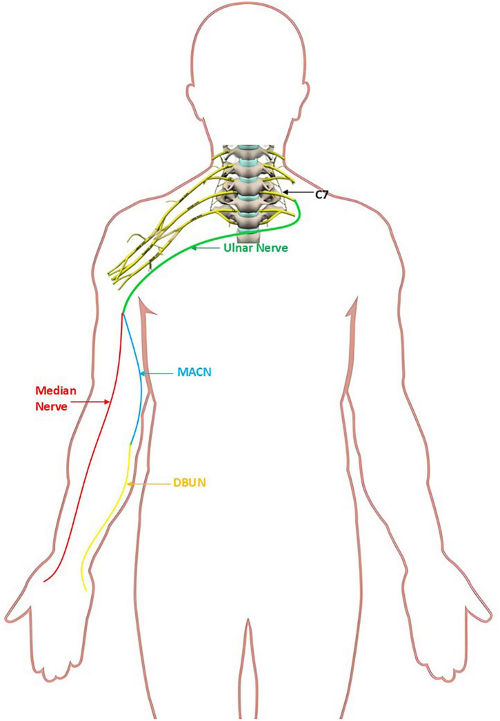 FIGURE 1