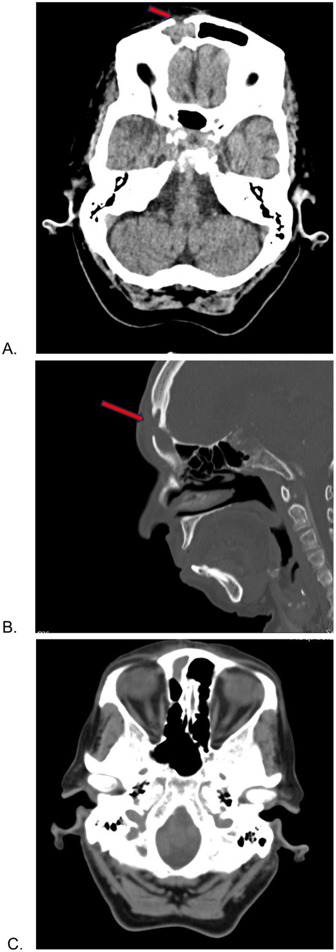 FIGURE 2