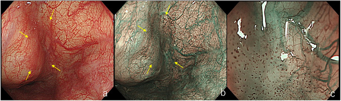 FIGURE 3