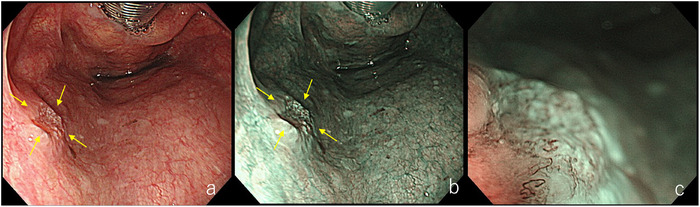 FIGURE 4