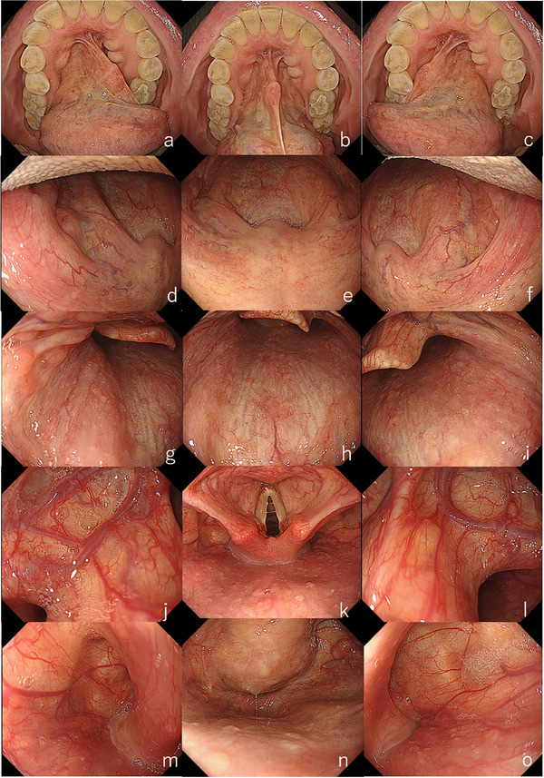 FIGURE 1
