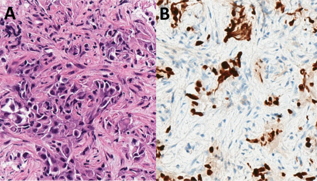 Figure 1