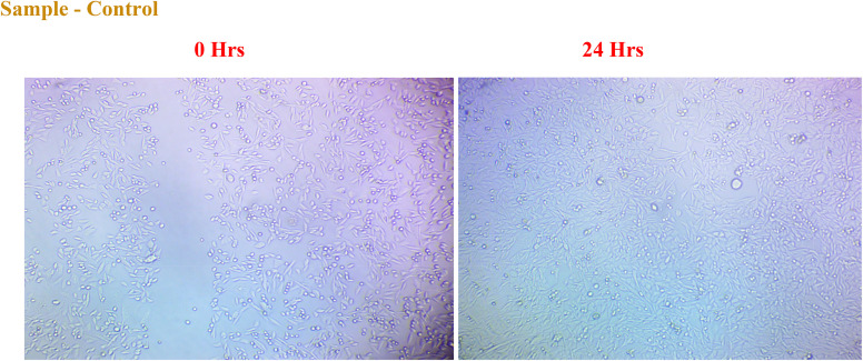 Fig. 18