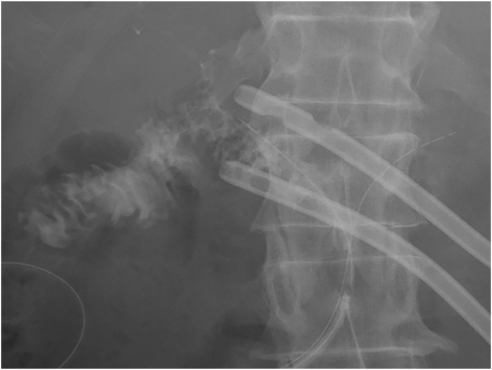 FIGURE 3