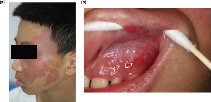 FIGURE 1
