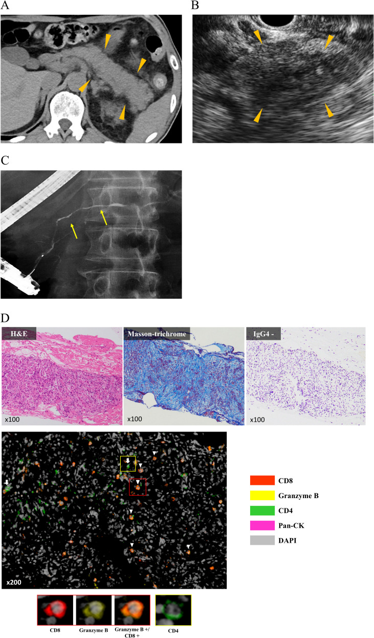Figure 2