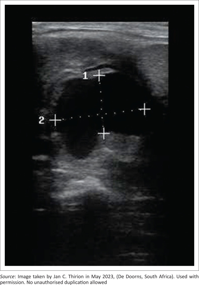 FIGURE 1