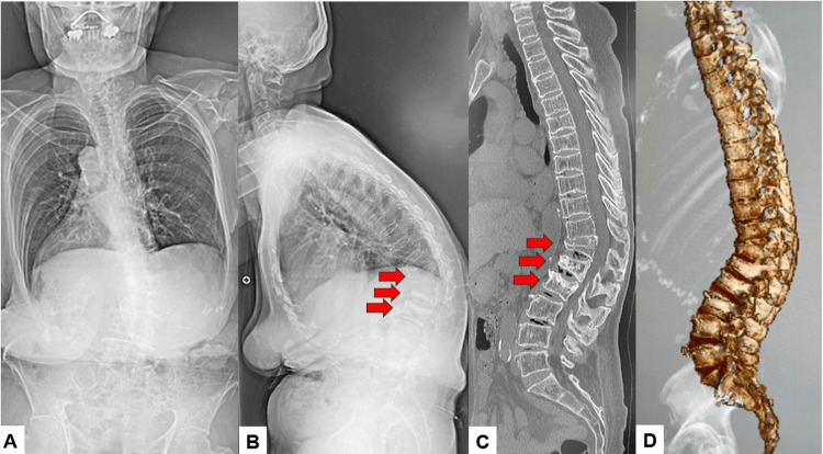 Figure 11