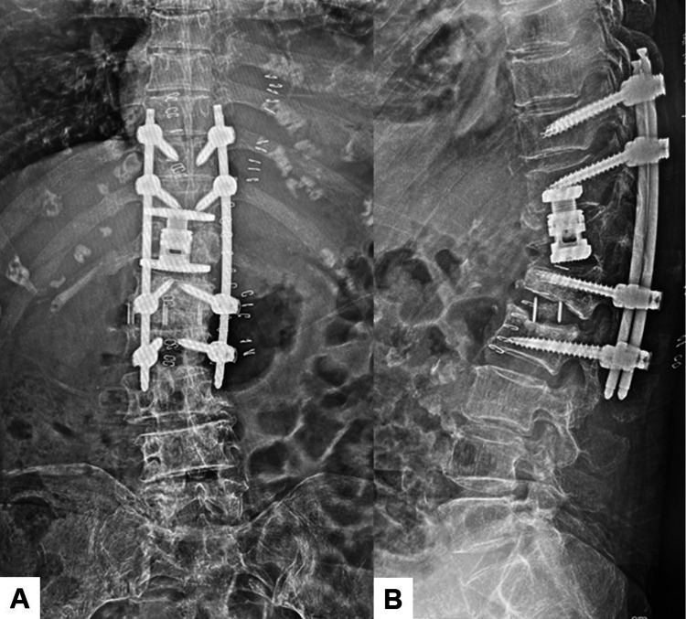 Figure 12