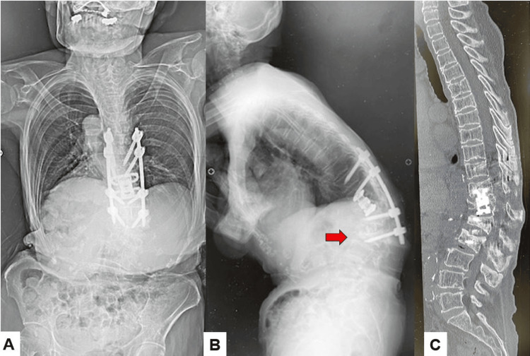 Figure 13