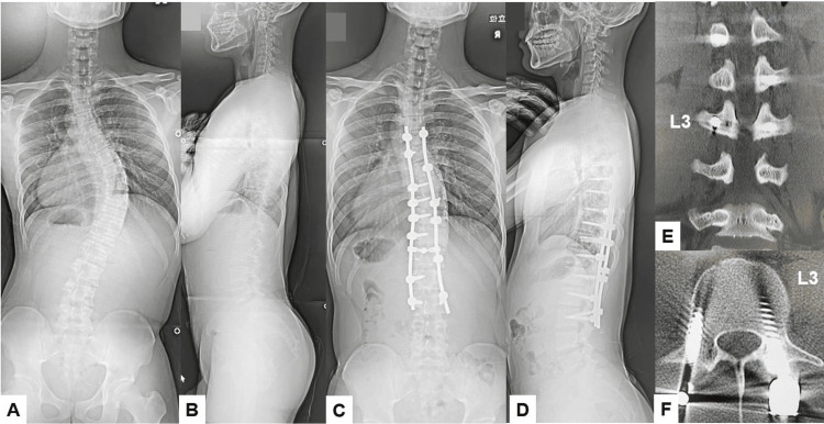 Figure 14